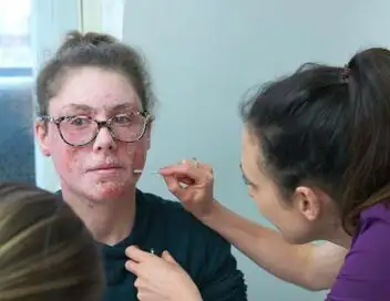 SOS Dermato - Saison 1 - Eczema-stential Crisis – affiche